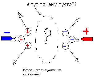 иst